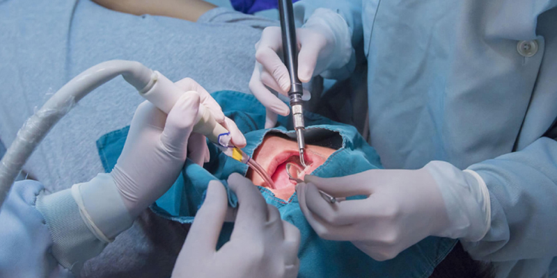 https://mm-turismodentale.com/wp-content/uploads/2023/05/chirurgia-dentale-01.jpg